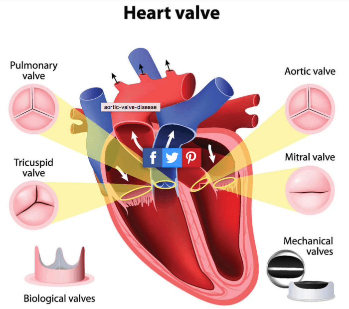 Roof of this chamber contains the bicuspid valve